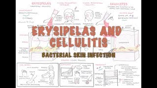 Bacterial Skin Infection  Cellulitis and Erysipelas Clinical Presentation Pathology Treatment [upl. by Eneg]