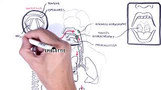 Stridor in children causes inspiratory and expiratory stridor pathophysiology [upl. by Norabal]