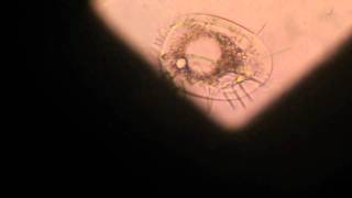 Rotifers and other micro species from a fish tank filter under microscopem2t [upl. by Nnylorac]