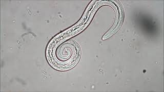 Aelurostrongylus abstrusus feline lungworm [upl. by Palmer157]