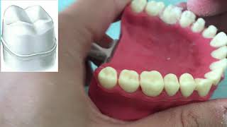 CROWN PREPARATION TUTORIAL MAXILLARY MOLAR [upl. by Base362]