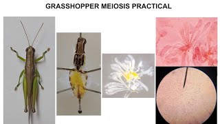 GRASSHOPPER MEIOSIS PRACTICAL [upl. by Kcirdneked517]