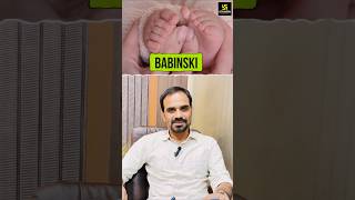 babinski reflex क्या है 👶🤔 shorts babyfacts [upl. by Nioe205]