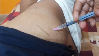 IM इंजेक्शन देने का सही तरीका  Easy steps to give Intramuscular injection  IM injection technique [upl. by Halvaard725]