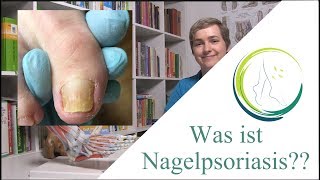 Haut trifft Nägel Psoriasis und ihre Auswirkungen im Detail mit podologinandrea [upl. by Milly]