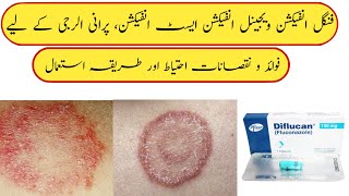 diflucan 150mg 1 capsule in urdu  diflucan capsule  diflucan fluconazole  diflucan 150 mg in Urdu [upl. by Annirok300]