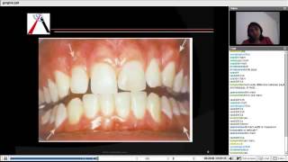 Periodontics  Gingiva and Tooth Supporting Structure [upl. by Caro411]