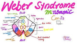 Weber SyndromeMnemonic for USMLEPlabFCPS medicine [upl. by Renell]