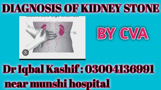 Diagnosis of kidney stones۔۔۔by Costovertebral angle tenderness۔ [upl. by Ellenij140]