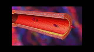 Infarctus du myocarde  IDM [upl. by Mellette]