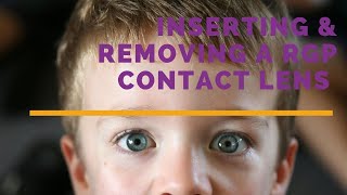 Inserting and removing a contact lens in a child [upl. by Jacki]