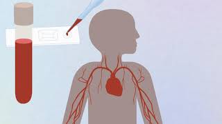 COVID19 animation Coronavirus and antibody testing explained [upl. by Yssenhguahs]