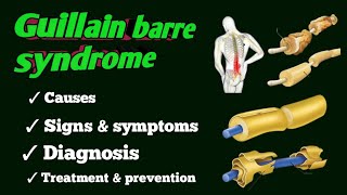 guillain barre syndrome [upl. by Anaiviv]