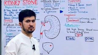 kidney stone class 12 types causes symptoms and treatment in Pashto MDCAT Biology [upl. by Dukey]