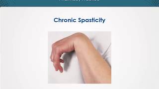 Chronic Spasticity  Neurologic Disorders  EduRx [upl. by Lladnyk]