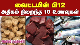 வைட்டமின் பி12 அதிகம் நிறைந்த உணவுகள்  Top 10 Vitamin B12 Foods in Tamil  Vitamin B12 Deficiency [upl. by Aneba512]