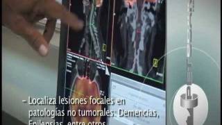 PETCT  Alta precisión en el diagnóstico del cáncer [upl. by Eserehc965]