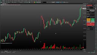 🟣 Trailing Stop [upl. by Cooperstein]