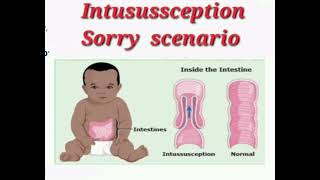 Gastroenteritis pt later Intusussception mrcpch Communication [upl. by Anialeh797]