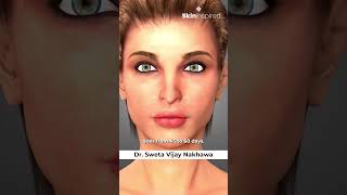 Why Does Skin Look Dull with Age Insights from Dr Sweta  DiscoverBeauty SkinCareTips [upl. by Nosydam]