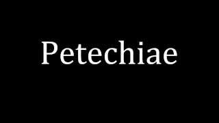 How to pronounce Petechiae [upl. by Hadlee]