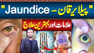 Jaundice Symptoms and Treatment  Jaundice Foods To Eat and Avoid  Pela Yarkan Ka ilaj [upl. by Canning]