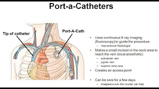 24 Principles of Port A Cath Placement amp Management [upl. by Graeme883]