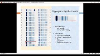 Lecture 103rd part electrophoresis Gamma protein electrophoresis interpretationDr Gehad ELmazny [upl. by Larimore717]