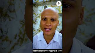 alopecia areata natural treatment How to prevent PATCHY HAIR LOSS  Dr Bansal  ganjapan [upl. by Tobit]