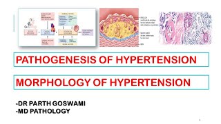 Hypertension  Pathogenesis  Morphology  Arteriosclerosis [upl. by Nuri]