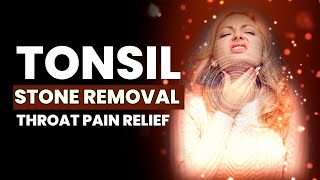 Tonsil Stone Removal  Throat Pain Relief  Heal Your Tonsils  All Throat Problems Healing  741Hz [upl. by Noillimaxam]