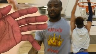 PUT BACK DUNK Youtubers Vs Fans 5 vs 5 GONE WRONG Dislocated Pinky Finger WLostNUnbound Lsk [upl. by Rind254]