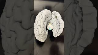 Subthalamic Nucleus amp Globus Pallidus [upl. by Aenyl]