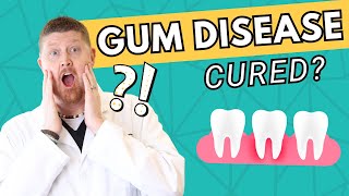 Can GUM DISEASE be Cured  Symptoms Oral Hygiene amp Treatment [upl. by Apeed]