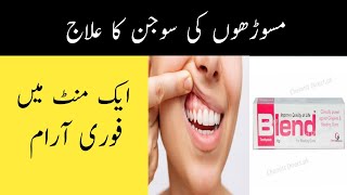 Masoro ki Sujan ka ilaj  Gum Swelling Treatment in Urdu amp Hindi [upl. by Yul]