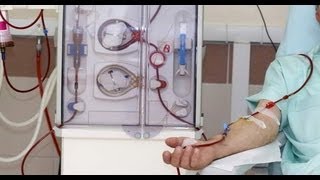 Kidney dialysis All you need to know Dr Deepa Jayaram [upl. by Elbart]