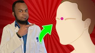 2 Minute Eustachian Tube Dysfunction Hack [upl. by Eniluqaj662]