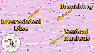 Heart Histology  Valveuable Insights [upl. by Naibaf]