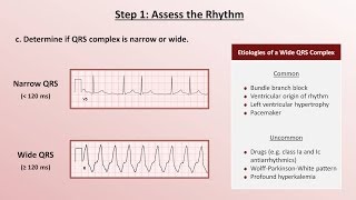 Intro to EKG Interpretation  A Systematic Approach [upl. by Edak]