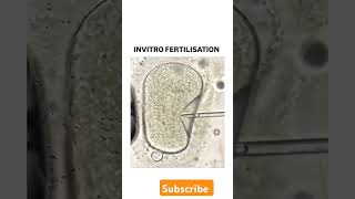 Invitro Fertilisation youtubeshorts youtube shorts viralvideo education neet [upl. by Ainoyek]