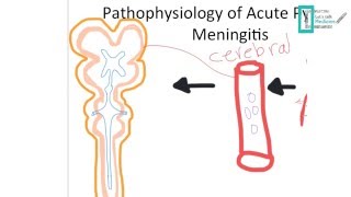 Meningitis Part 1 [upl. by Adyan]