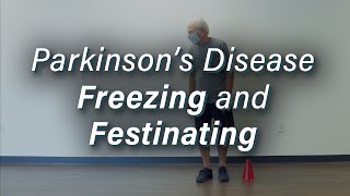 Parkinsons Disease Freezing amp Festinating Gait [upl. by Losse]