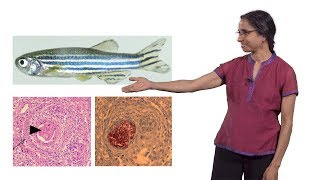 Lalita Ramakrishnan Cambridge 2 The Troublesome Tubercle in Tuberculosis [upl. by Erika766]