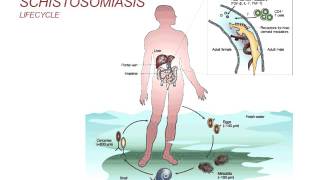 Webinar Schistosomiasis  Diagnosis and Treatment 2014 [upl. by Eitsim]