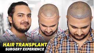 Hair Transplant in Muzaffarnagar  Best Results amp Cost of Hair Transplant in Muzaffarnagar [upl. by Aoket]