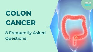 Colon Cancer 8 Frequently Asked Questions [upl. by Helmer]