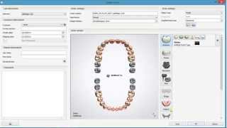 How to create a Full Dentures Order in 3Shape Dental System 2015 [upl. by Russell981]