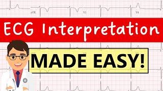 How to interpret an ECG systematically  EXPLAINED CLEARLY [upl. by Larkins726]