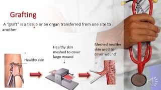 Manahej SchoolGrade 8 Biology Types of Grafts [upl. by Lomaj353]