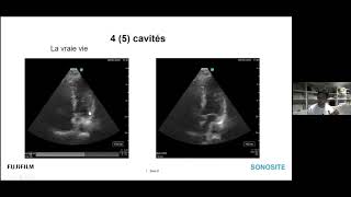 Webinaire Echographie thoracique en Anesthésie [upl. by Yntirb]